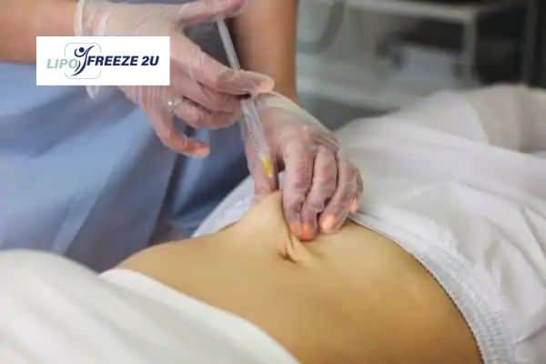 How Does Aqualyx Fat Dissolving Injection Work to Break Down Fat Finchley?