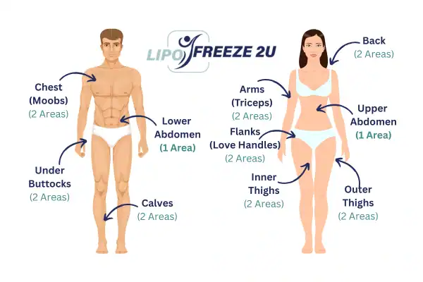 Areas you can have fat freezing treatment Finchley