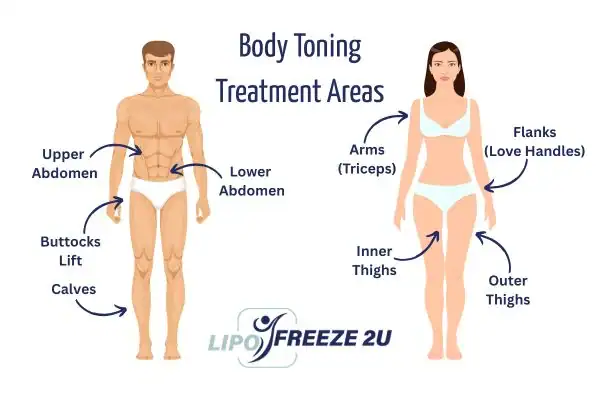 Graphic showing where you can have Body toning Treatment Finchley on your body
