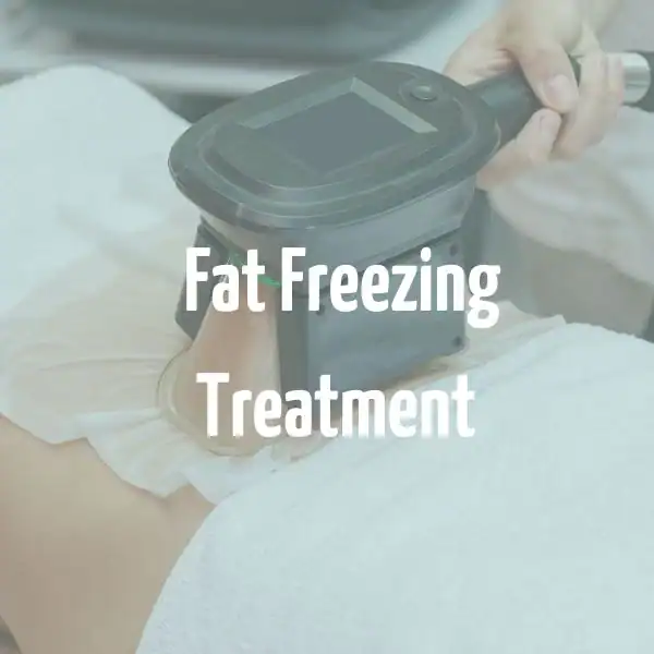 fat freezing treatment Finchley