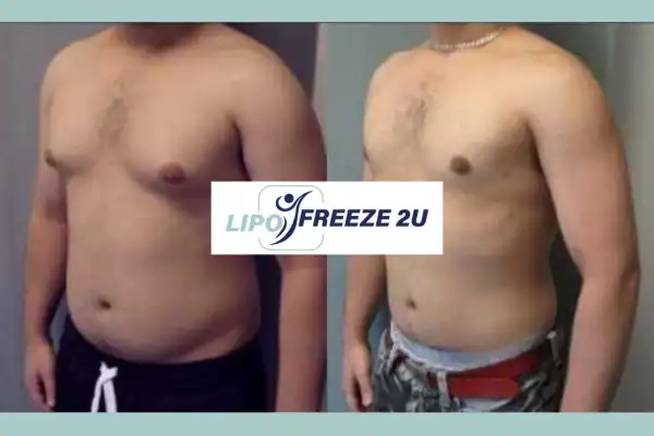 How Long Does It Take to See Results Finchley?